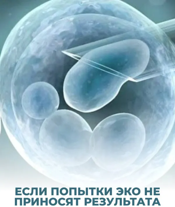 Что делать, если попытки ЭКО не приносят результата